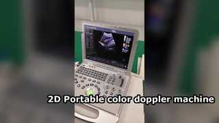 Φορητό μηχάνημα έγχρωμου doppler US15 Plus 2D