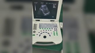 Πλήρης ψηφιακός φορητός υπολογιστής Διαγνωστικό σύστημα υπερήχων 80element BR-US11