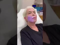 Μηχάνημα εύρεσης φλεβών QV 600 για ακριβή φλεβοκέντηση