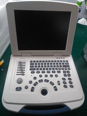 Full-digital laptop Ultrasound Diagnostic System 80element