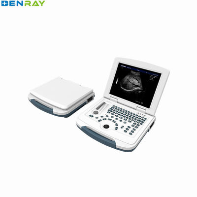 Πλήρης ψηφιακός φορητός υπολογιστής Supersound Diagnostic System 96 στοιχείο
